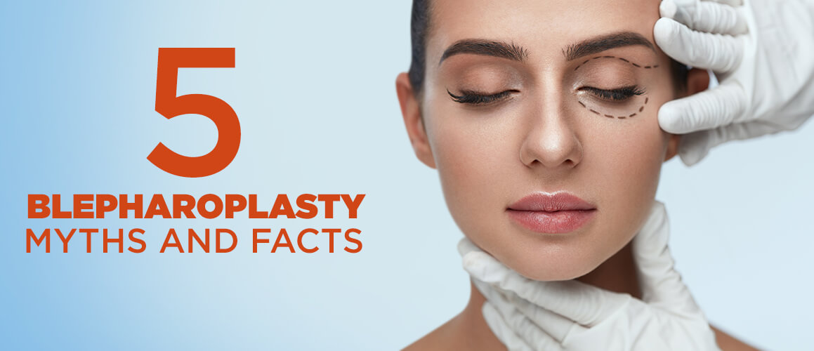 5 Blepharoplasty Myths and Facts